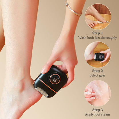 Electric Foot Callus Remover & Heel Care Device