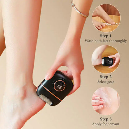 Electric Foot Callus Remover & Heel Care Device