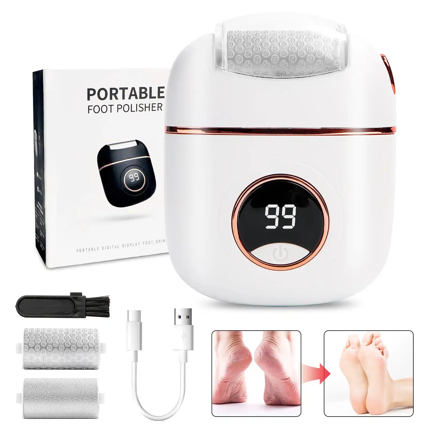 Electric Foot Callus Remover & Heel Care Device
